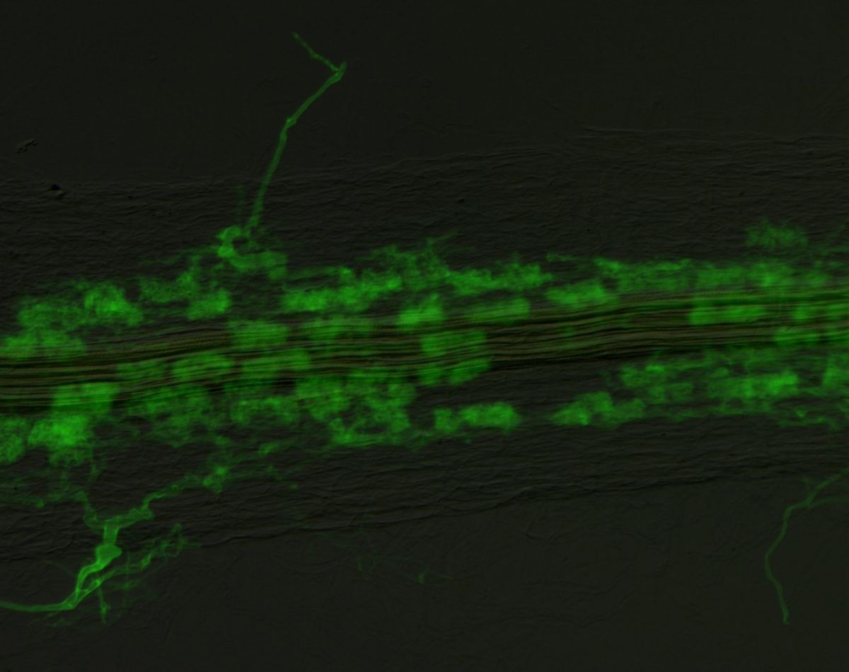 Symbiose zwischen Pflanzenwurzel und Pilz: Der Pilz ist hier grün dargestellt. (Bildquelle: © Dr. Daniela Floss)