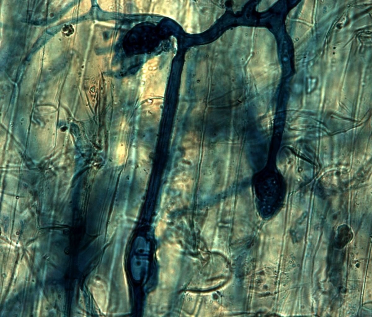 Arbuskelzweig von Rhizophagus irregularis in der Wurzel einer Ackerbohne (Vicia faba).