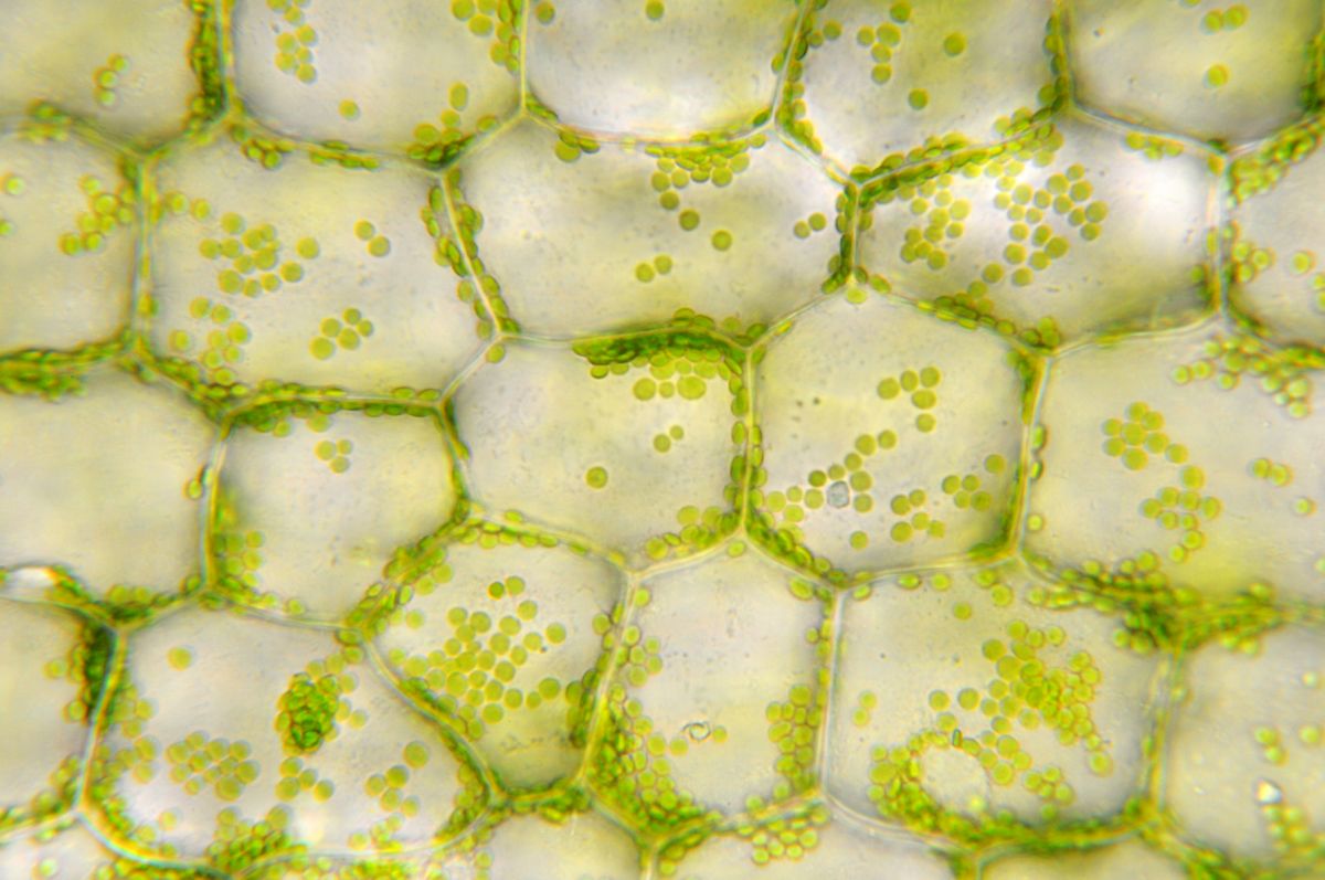 Alles schön grün hier: Choroplasten sind gemäß der Endosymbiontentheorie „Nachfahren“ der Cyanobakterien.
