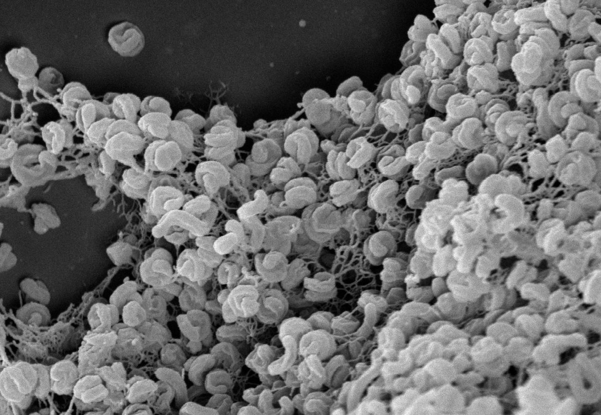 Elektronenmikroskopische Aufnahme eines Zell-Aggregats von Comammox-Bakterien der Art Nitrospira inopinata. (Bildquelle: © Anne Daebeler und Stefano Romano)