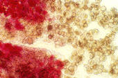Antheren (rot angefärbt) und Pollenkörner unter dem Mikroskop