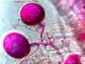 Chlamydosporen - ungeschlechtliche Fortpflanzungszellen - des Mykorrhizapilzes 