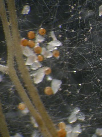 Arbuskuläre Mykorrhizapilze dringen in die Wurzelzellen der Pflanzen ein. Hier: Der Pilz Gigaspora margarita, der eine Symbiose mit den Wurzeln des Gewöhnlichen Hornklees eingegangen ist. (Quelle: © Mike Guether / Wikimedia.org; CC BY 3.0)