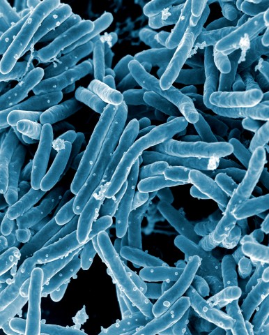 Gefährliches Bakterium: Der Tuberkulose-Erreger Mycobacterium tuberculosis.