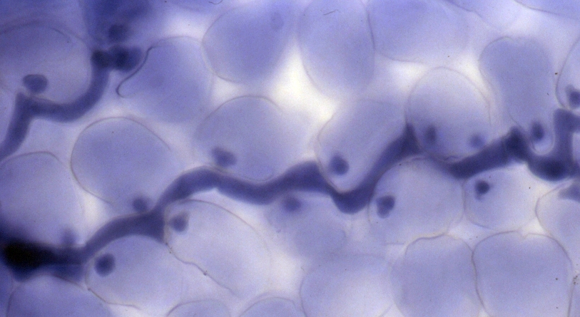 Der Pils Hyaloperonospora parasitica dringt in die Pflanzenzellen ein und bildet dort Hyphen und Haustorien.