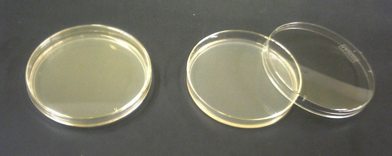 Weil Nährmedien (hier:Petrischalen) in der Regel alle wesentliche Nährstoffe anbieten, fiel das Ammoniumdefizit zunächst nicht auf.