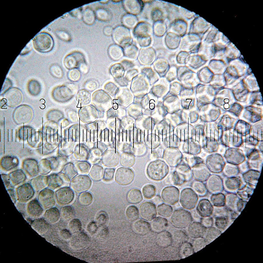 Saccharomyces cerevisiae. Die Teilstriche entsprechen jeweils einem Mikrometer.
