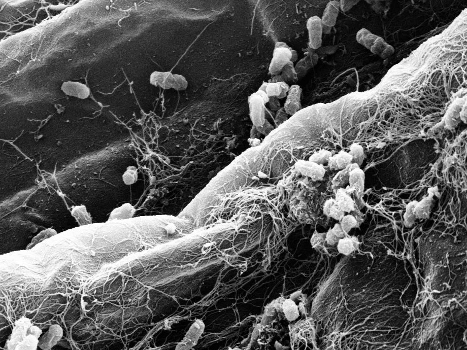 Besiedlung der Wurzeln durch Bakterien der Wurzelmikrobiota.
