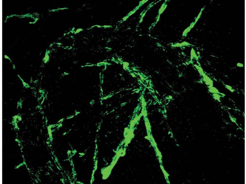 Bakterien der Gattung Klebsiella wurden mit einem grün fluoreszierende Protein markiert und so sichtbar gemacht. Die Bakterien befinden sich in der Rhizosphäre. 