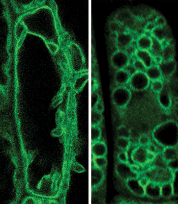 Fluoreszenz-Mikroskopische Aufnahmen einer wildtypischen (links) und einer mutierten (rechts) Zelle. Die Membran der Vakuole ist grün markiert. (Quelle: ©TU München/Systembiologie der Pflanzen)