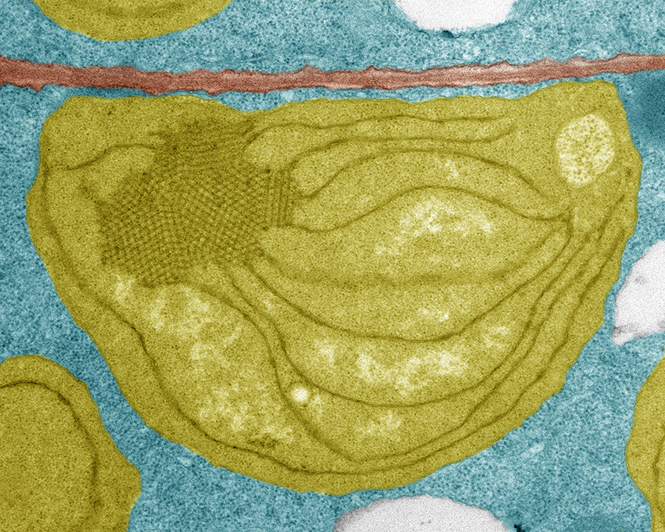 Proplastid (gelb) in einer Samenembryozelle. Die Wand (braun) trennt zwei Zellen, ihre Vakuolen (hellgrau) und ihr Zytoplasma (blau).