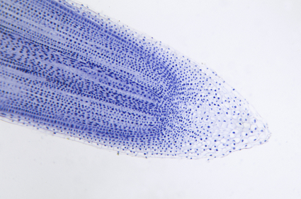 Zwiebelwurzel unterm Mikroskop  (Quelle:© iStockphoto.com/ Karl Dolenc)
