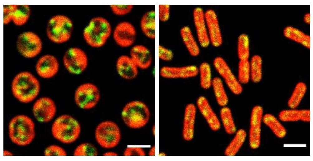 Lokalisation der mRNAs für Thylakoidmembranproteine und der Pigmente der Thylakoidmembran mit einem konfokalen Mikroskop von zwei verschiedenen Cyanobakterienstämmen: Autofluoreszenz der Pigmente der Thylakoidmembran (rot), die Signale von mRNAs (grün) sowie die Kolokalisation beider Signale (gelb).
