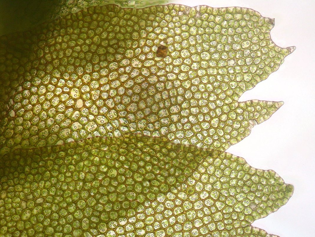 Pflanzenzellen im Detail, hier von der Lebermoos-Art Bazzania flaccida. (Bildquelle: © HermannSchachner / wikimedia.org / CC0)
