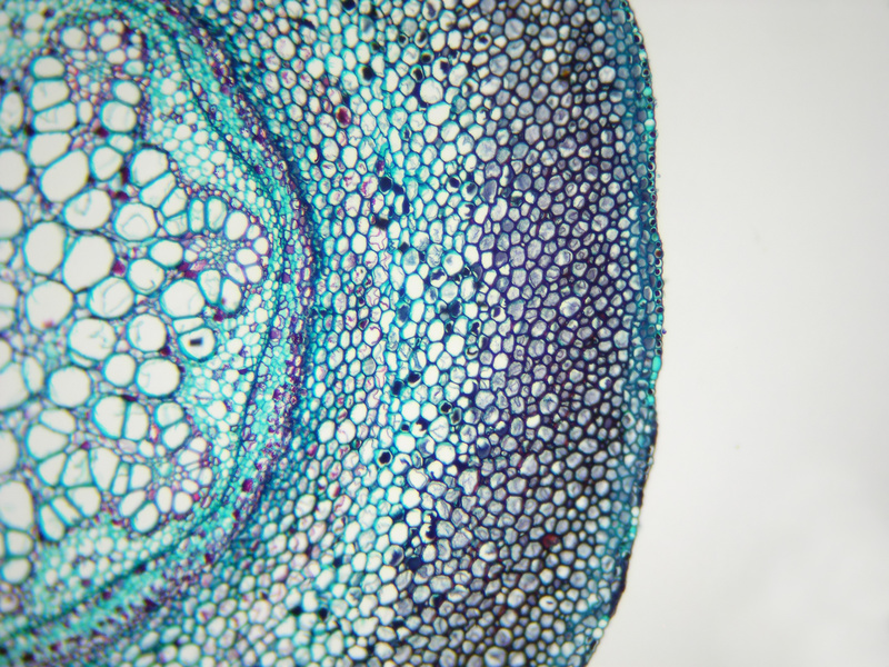 Pflanzenzellen unterm Mikroskop. Kann man die Zelldifferenzierung rückgängig machen? (Bildquelle: © Garry DeLong / Fotolia.com)