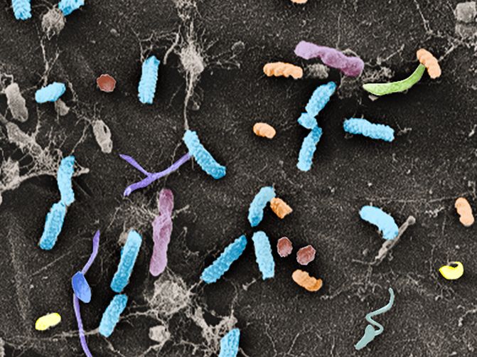 Diese kolorierte elektronenmikroskopische Aufnahme zeigt unterschiedliche Bakterienarten an der Wurzeloberfläche der Ackerschmalwand. (Bildquelle: © Rainer Franzen, Palom Duren / Bildbearbeitung Magdalena Kosterska-Singer)