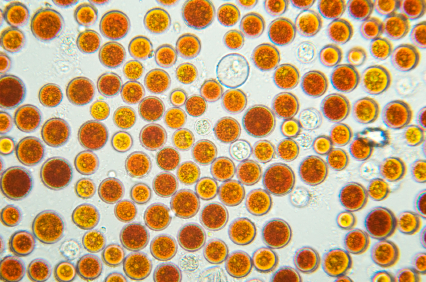 Die Mikroalge Haematococcus pluvialis unter dem Mikroskop. Aus hier kann die Omega-3-Fettsäure Docosahexaensäure (DHA) gewonnen werden, die Fisch so gesund macht. 