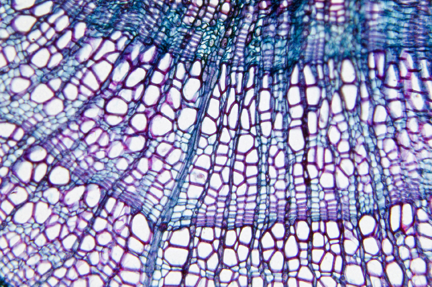 Holzzellen im Mikroskop: Lignineinlagerungen imprägnieren die Leitungsbahnen und helfen der Pflanze, aufrecht zu stehen. (Quelle: © iStockphoto.com/ BeholdingEye)