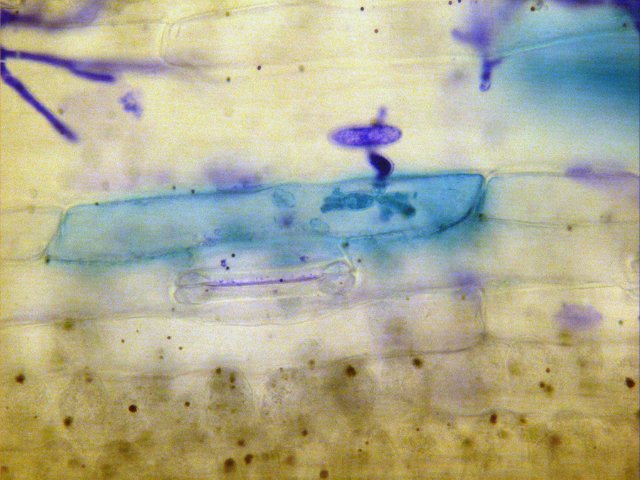 Haustorium: Einzelne Zelle (blau angefärbt) eines Weizenblatts, die durch eine Mehltauspore befallen ist. Innerhalb der Zelle ist die fingerförmige Struktur des Mehltaus sichtbar, durch die der Pilz Nährstoffe aus der Pflanzenzelle aufnimmt.