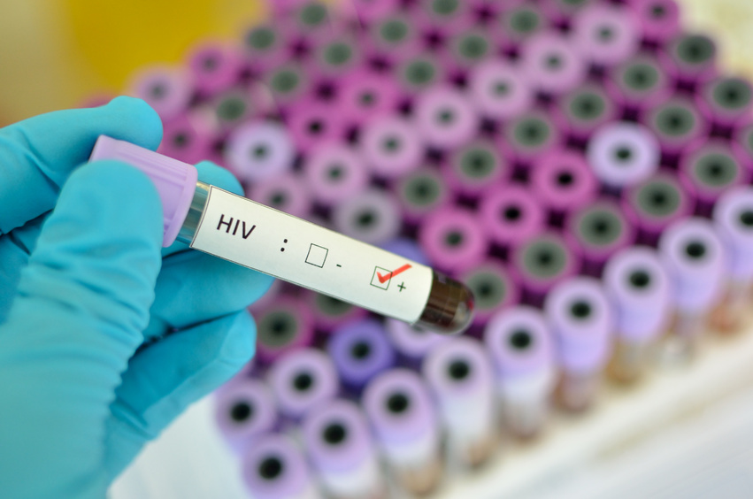 Im Jahr 2012 waren über 35 Millionen Menschen weltweit mit dem HI-Virus infiziert, knapp 2 Millionen starben an der von HIV ausgelösten Krankheit AIDS.