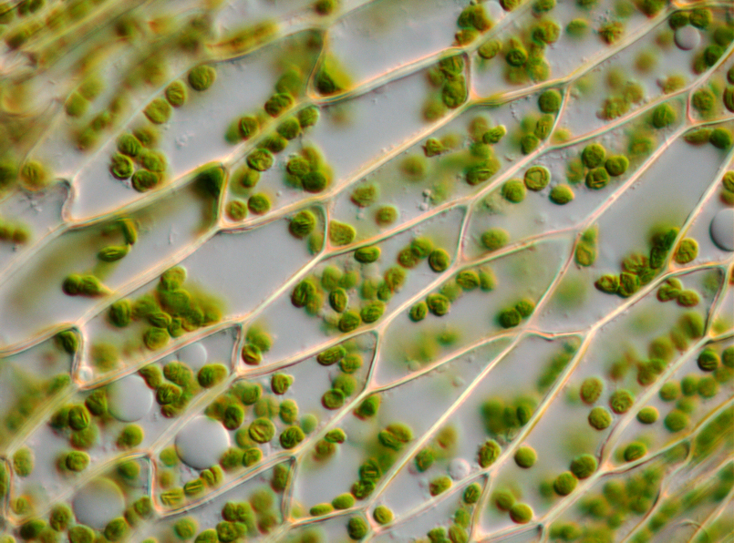 Die Cellulose ist der Hauptbestandteil der Zellwände (hell im Bild) von Pflanzenzellen. Das Bild zeigt ein Moosblatt unter dem Mikroskop. Bei den grünen Punkten handelt es sich um die Chloroplasten.