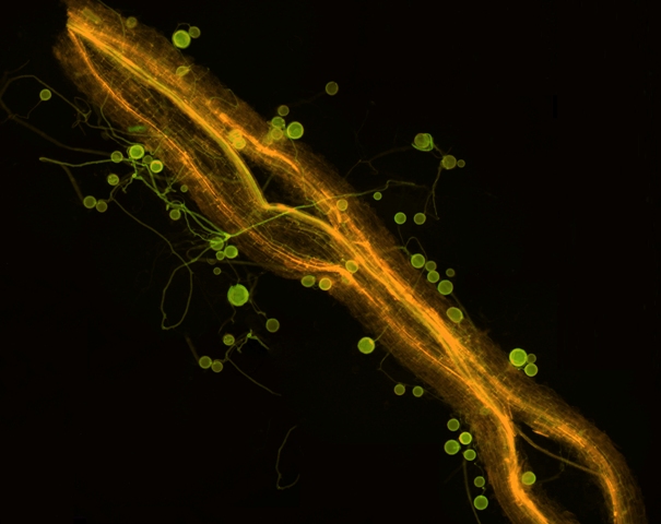 Die fluoreszenzmikroskopische Aufnahme zeigt eine arbuskulär mykorrhizierte Wurzel mit den Hyphen und Sporen des Pilzes. Bei dieser Form der Symbiose entwickelt der Pilz baumartig verzweigte, zarte Hyphen, sogenannte Arbuskeln.