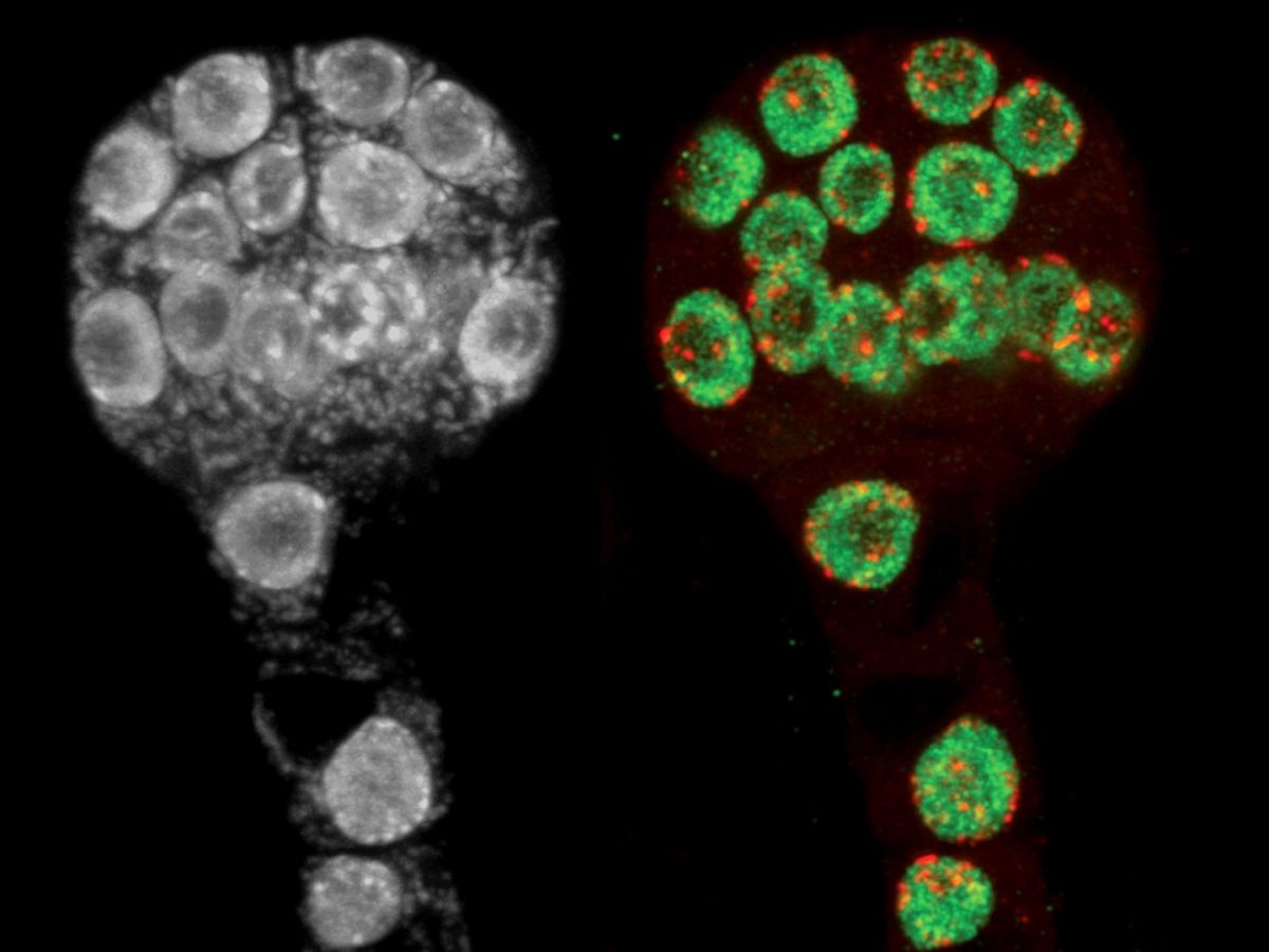 Die Fotos zeigen frühe Embryonen der Ackerschmalwand mit epigenetischen Veränderungen in grün und rot rechts bzw. grau links. (Bildquelle: © Daniel Grimanelli and Jean-Sébastien Parent/Martienssen lab, CSHL/2021)