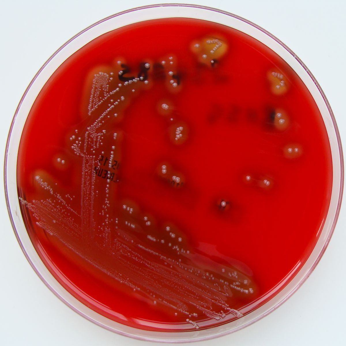 Cas9 ist ein bakterielles Protein, das zum Beispiel aus dem hier abgebildeten Bakterium Streptococcus pyogenes isoliert wird. (Quelle: © Nathan Reading / wikimedia.org; CC BY 2.0)
