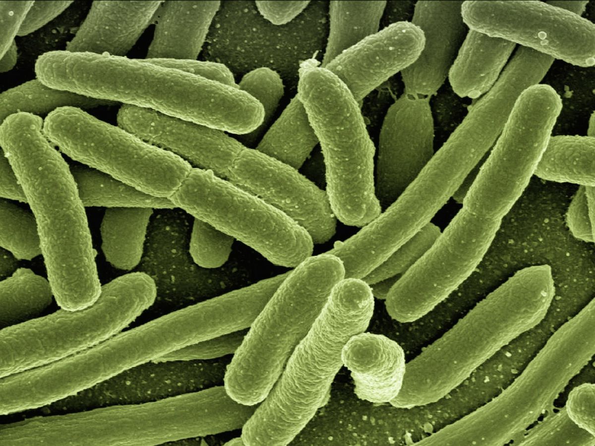 Praxistests an E.coli-Bakterien waren erfolgreich. (Bildquelle: © gemeinfrei / Gerd Altmann / Pixabay)
