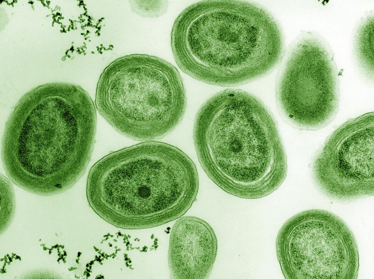 Ohne Cyanos nix los: Cyanobakterien sind die Wegbereiter unserer heutigen sauerstoffhaltigen Atmosphäre. Hier zu sehen: Ein Mikroskopbild (TEM) von Prochlorococcus marinus, das nachträglich grün eingefärbt wurde. 
