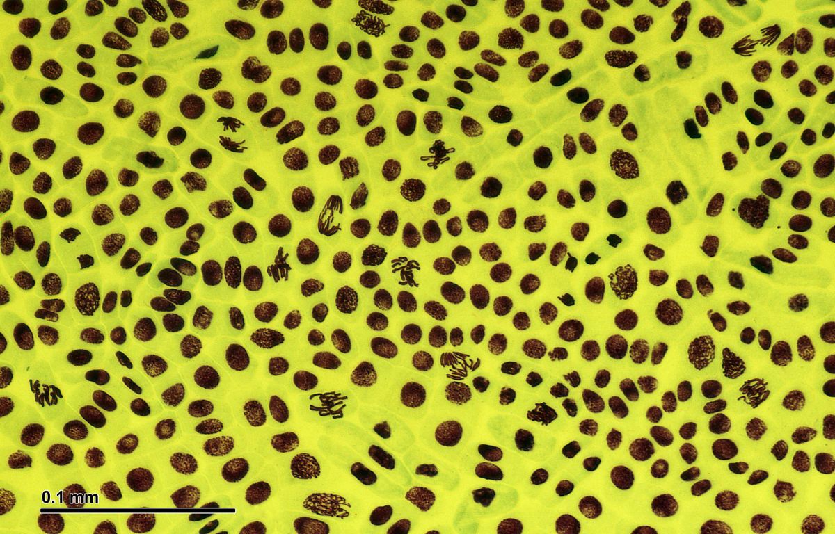 Blick durch das Mikroskop auf das Wurzelmeristem der Ackerbohne. Es ist das Bildungsgewebe, in dem laufend neue Zellen gebildet werden und sich anschließend differenzieren. (Bildquelle: © Josef Reischig/ wikimedia.org/ CC BY-SA 3.0)