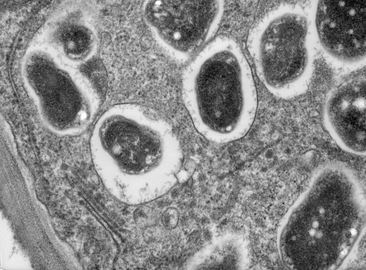 Mikroskopaufnahme eines Wurzelknöllchens der Sojabohne (Glycine max). Es enthält hunderte Millionen Bradyrhizobium-Bakterien.