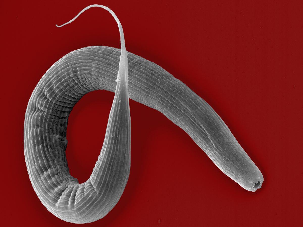 Nematoden der Art Pristionchus pacificus dienen der Wissenschaft als Modellorganismus. (Bildquelle: © Jürgen Berger/MPI für Biologie)