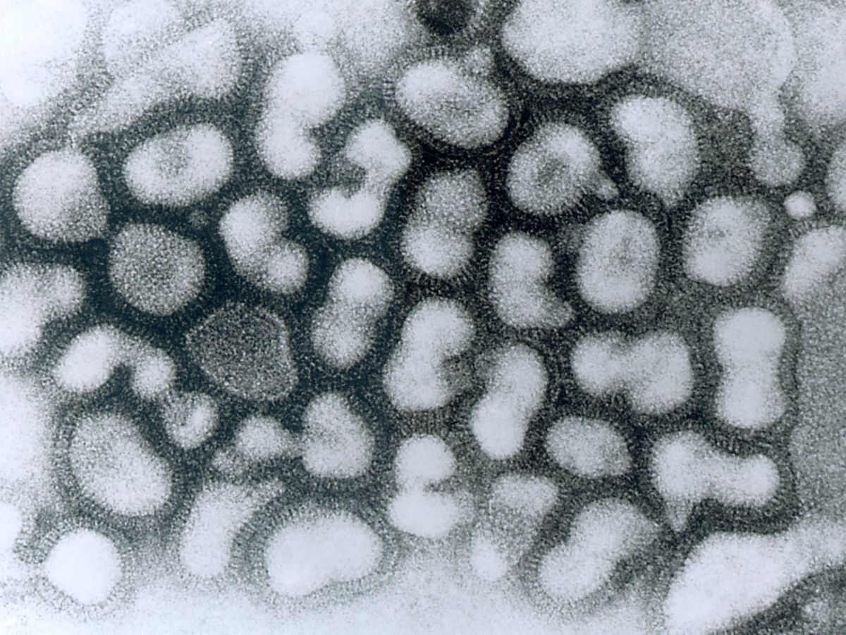Aviäres Influenzavirus (HPAIV), elektronenmikroskopische Aufnahme.
