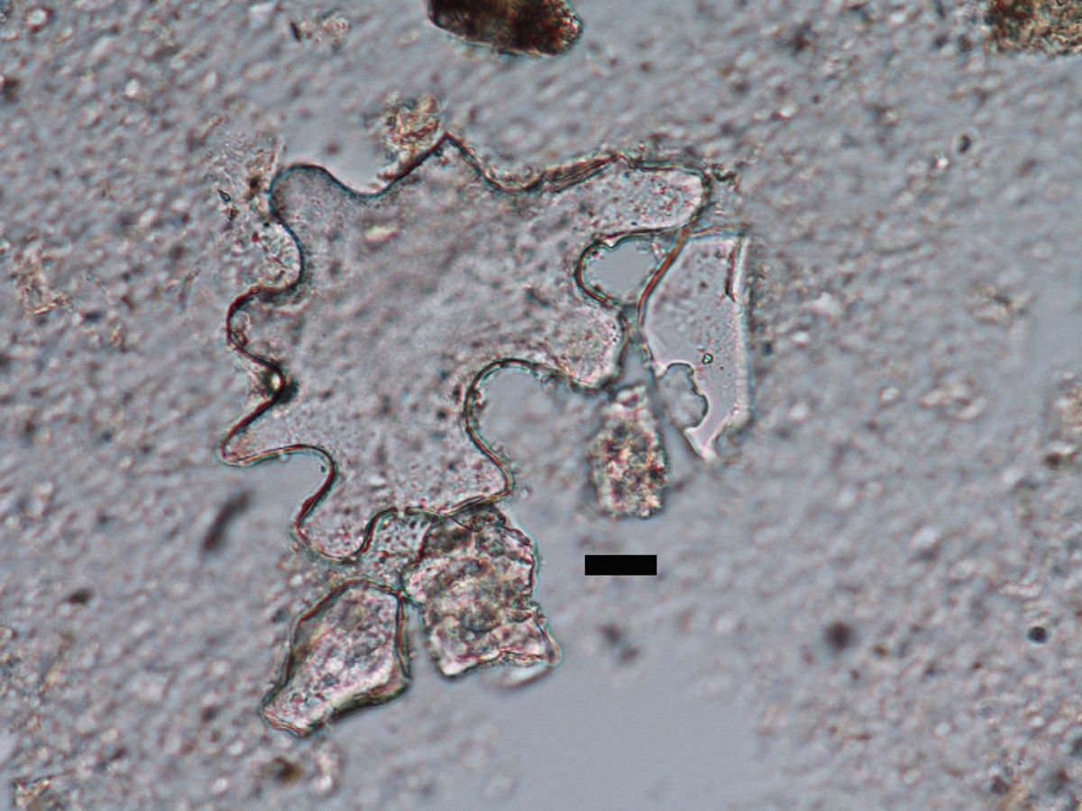 Ein 49 Millionen-jähriger Phytolith aus einer fossilen Pflanzenzelle. Die kurvenreiche und große Form, weißt auf ein Wachstum unter schattigen Bedingungen hin. Balken = 10 Mikrometer. (Bildquelle: © Regan Dunn/University of Washington)