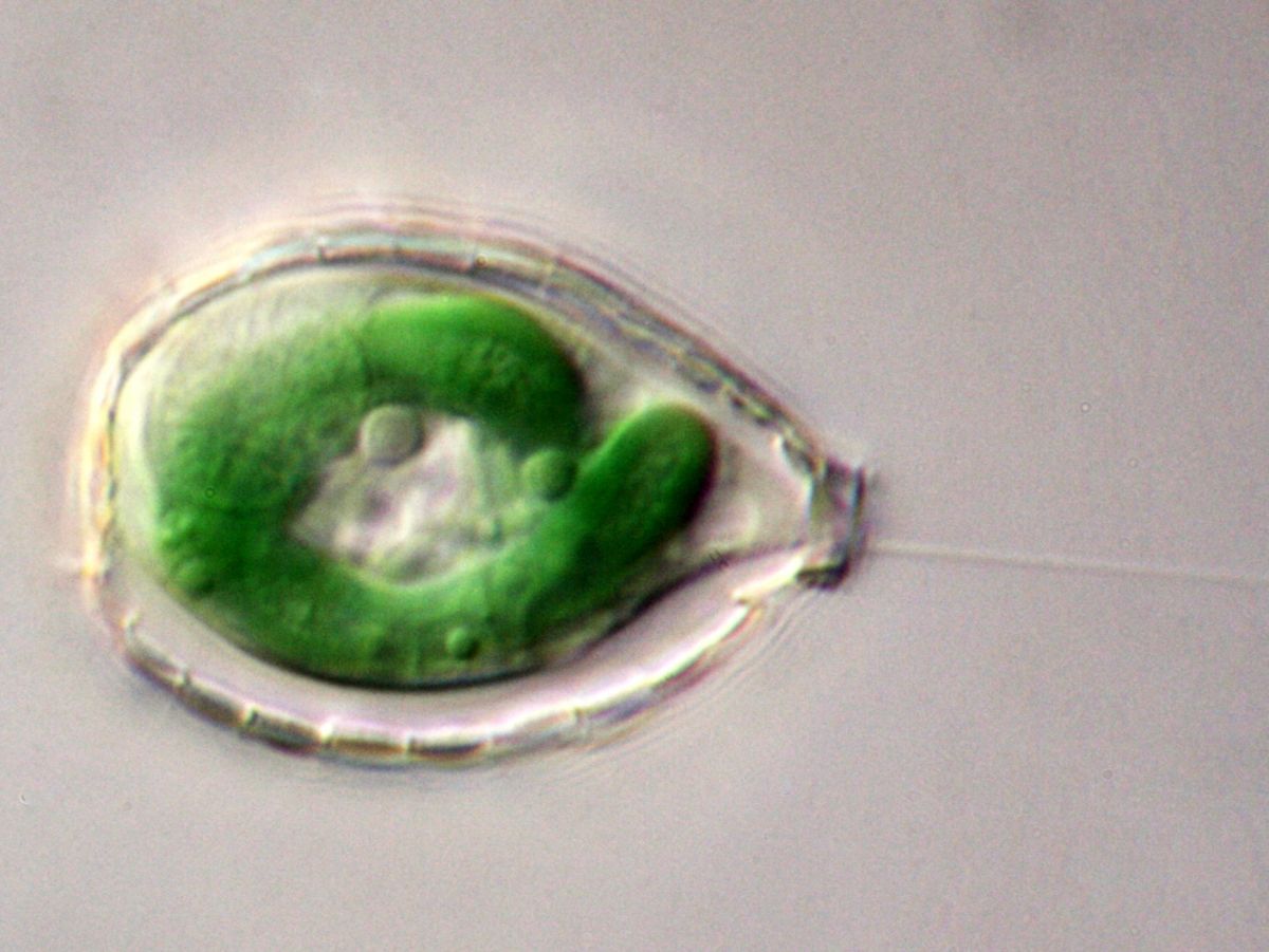 Unter dem Mikroskop wird das grüne Cyanobakterium in der Schalenamöbe Paulinella chromatophora sichtbar.
