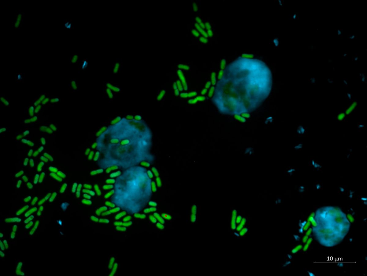 Bakterien der Gattung Pseudomonas (im Bild grün) sind giftig für Amöben (im Bild blau). Hier sieht man, wie Amöben trotzdem versuchen, diese Bakterien zu verdauen. (Bildquelle: © Harikumar Suma/Leibniz-HKI)