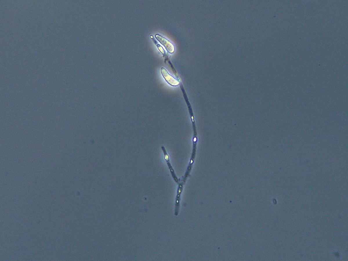 Sporen des Pilzes Rhynchosporium commune: Nicht immer sind Infektionen auch äußerlich sichtbar. Dann hilft nur eine Analyse im Labor.
