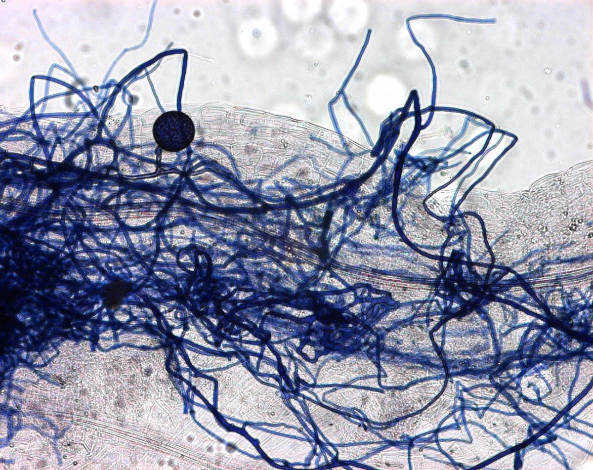 So sehen die Verflechtungen von Pilz (blau) und Pflanzenwurzeln unter dem Mikroskop aus. Hier ist ein arbuskulärer Mykorrhizapilz abgebildet. Solche Pilze betreiben Endomykorrhiza - die feinen Pilzfäden dringen also in die Wurzelrindenzellen der Pflanzen ein.
