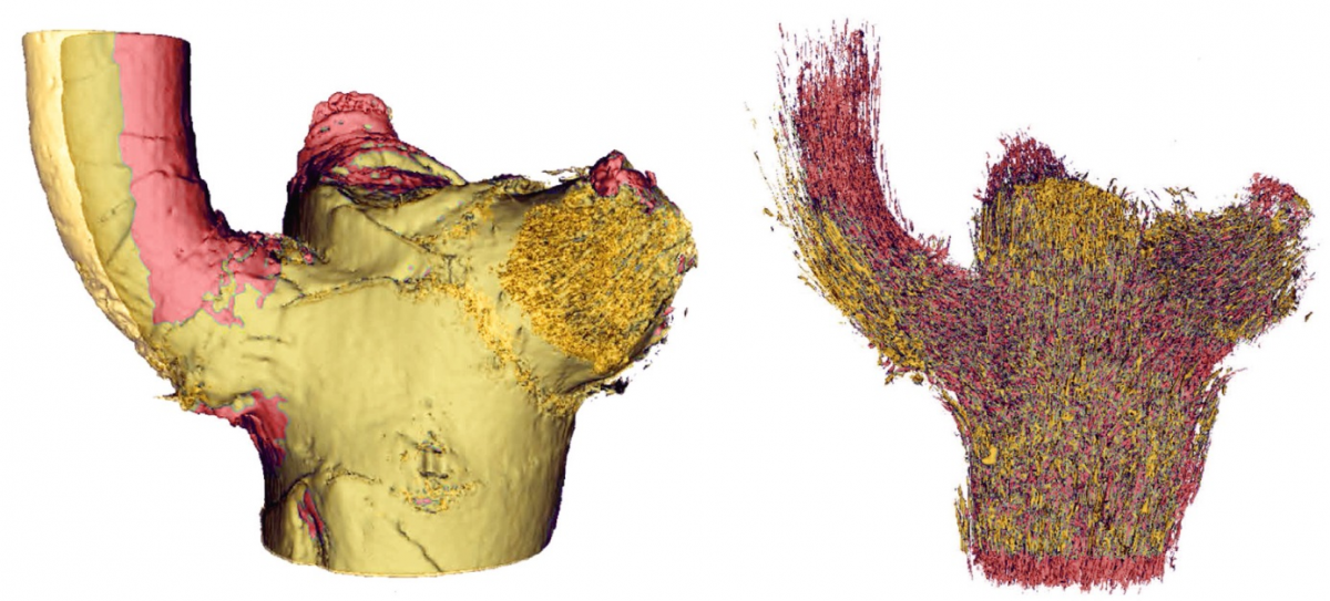 Das MRT-Verfahren ermöglichte den Wissenschaftlern, die Verzweigungen des Drachenbaums zu untersuchen, ohne die Pflanze dabei zu beschädigen. Hier abgebildet: Die Außenhülle (links) sowie das Leitbündelsystem (rechts) der Ast-Stamm-Anbindung im Drachenbaum im belasteten (gelb) und unbelasteten (rot) Zustand.