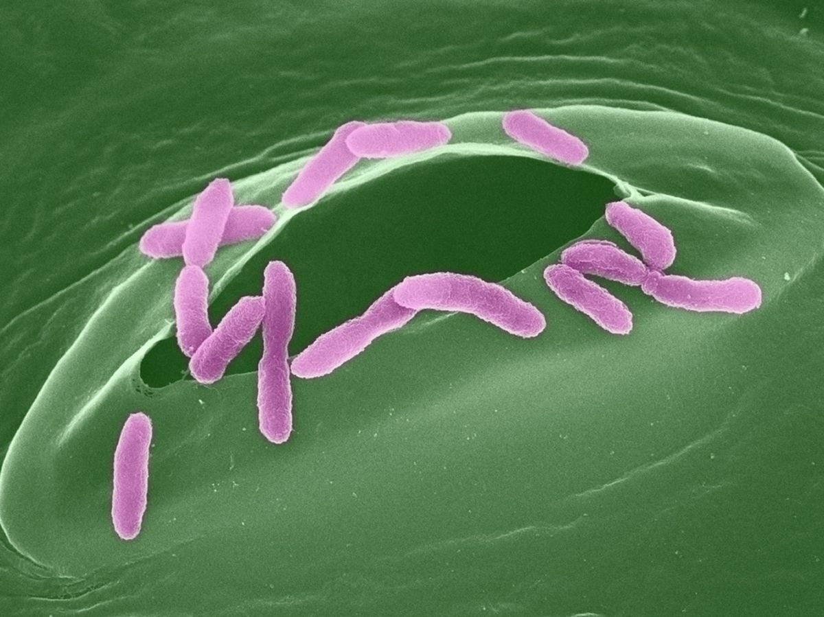 Kolorierte Rasterelektronenmikroskopaufnahme von Pseudomonas-Bakterien beim Eindringen in eine Spaltöffnung eines Pflanzenblatts. (Bildquelle: © Sonja Kersten, Max-Planck-Institut für Biologie Tübingen)