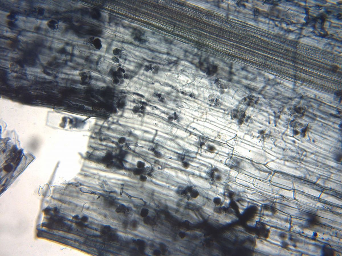 Mikroskopaufnahme von Arbuskeln (dunkel) in den Wurzelzellen von Weizen. (Bildquelle: © MS Turmel / wikimedia.org; gemeinfrei)