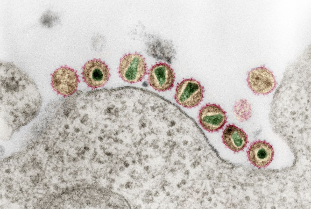 Auch bei der Behandlung einer HIV-Virus-Infektion könnte die CRISPR/Cas9-Technologie eingesetzt werden. Man arbeitet daran, die Eintrittspforte - durch die das Virus eindringt - in den weißen Blutzellen mithilfe der Genom Editierung abzuschalten, damit die modifizierten Zellen resistent gegen das Virus werden. 