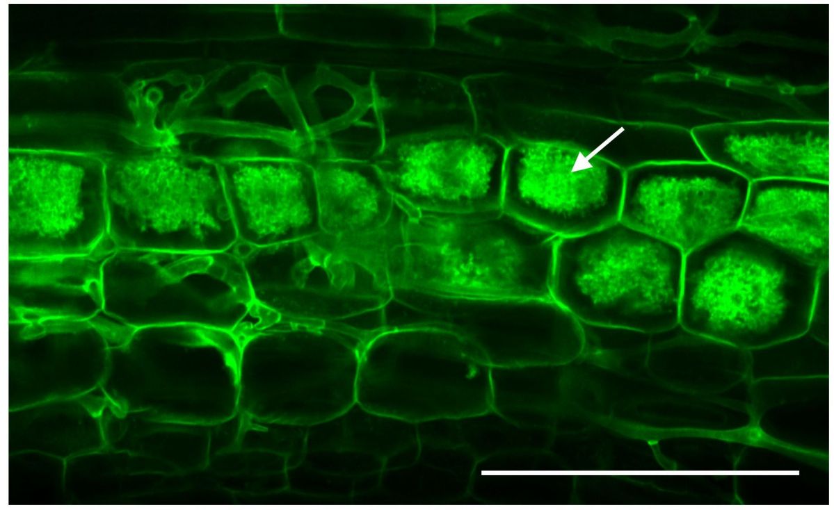 Unter dem Mikroskop (konfokalmikroskopische Aufnahme): Der AM-Pilz (grün) erreicht die innere Wurzelrinde und bildet dort die namensgebenden Arbuskeln (s. Pfeil; baumartige Struktur, Latein arbor = Baum).
