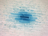 Durch Mikroinjektion wurde DNA in Zwiebelzellen eingeschleust. Das Genprodukt ist durch die blaue Farbe nachweisbar. Nur die Zelle im Zentrum wurde injiziert. Durch kleine Zell-Verbindungskanäle gelangte das Genprodukt auch in die umgebenen Zellen.